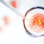 Canadian Clinics Optimize Egg Retrieval Success